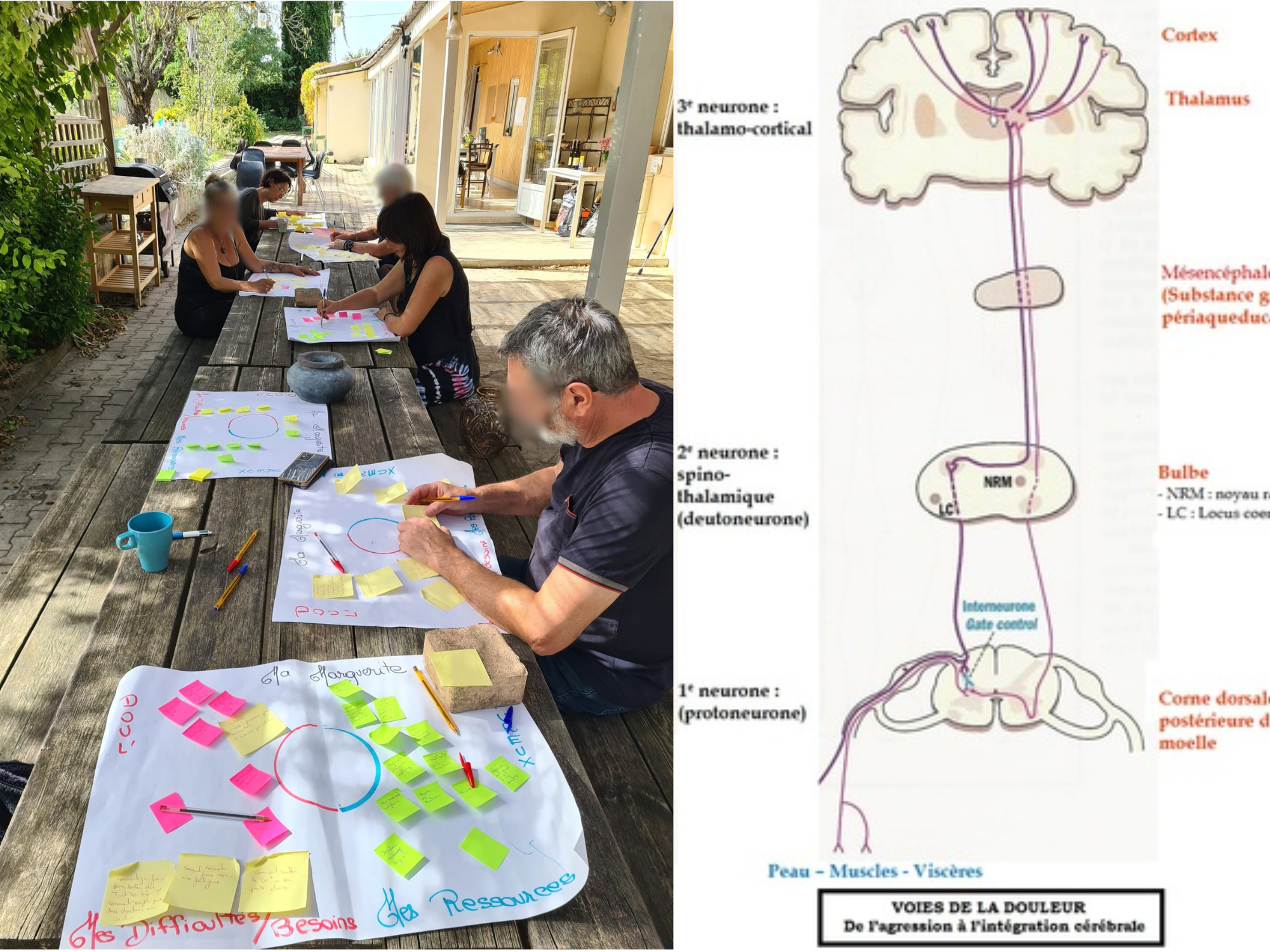 Atelier participatif avec post-it et schéma du cerveau